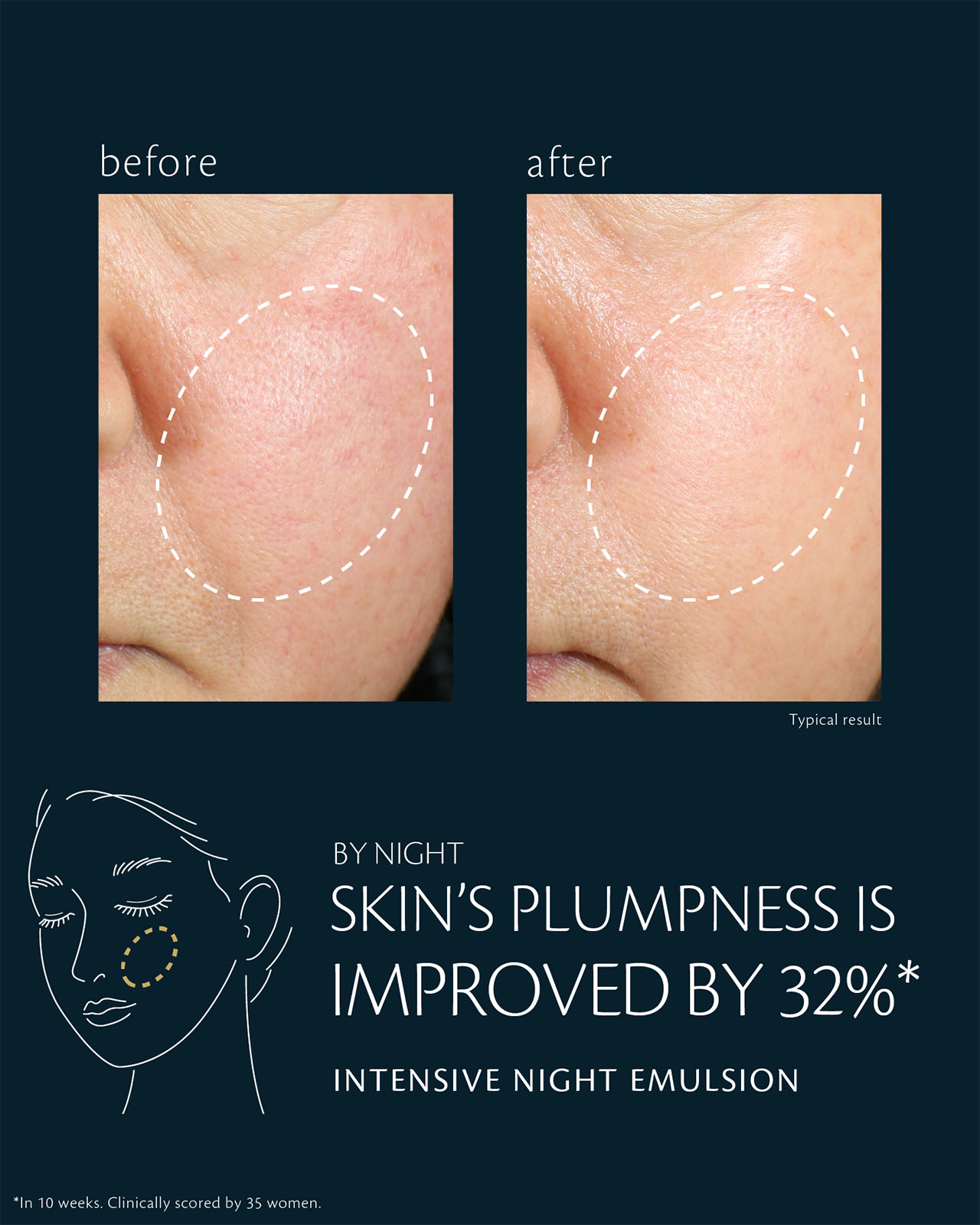 Photo of before-and-after comparison of cheek skin showing a 32% improvement in plumpness after using INTENSIVE NIGHT EMULSION. The left (before) shows dryness and slight loss of volume, while the right (after) appears plumper and firmer. *In 10 weeks, clinically scored by 35 women.