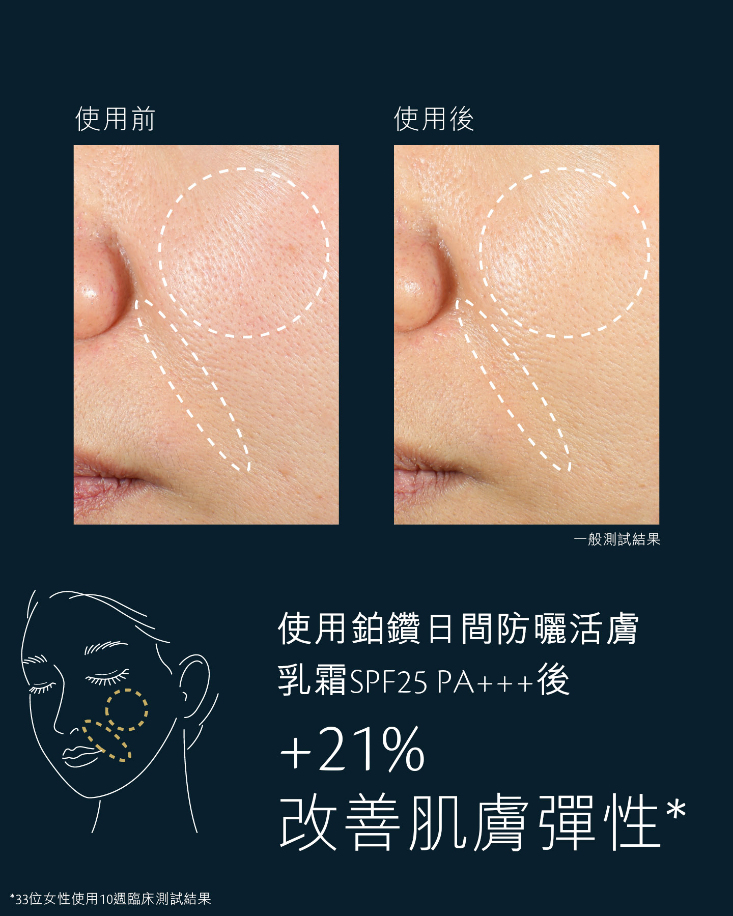 相片顯示鉑鑽日間防曬活膚乳霜SPF25 PA+++使用前後的面頰肌膚對比，證實4星期後彈性提升了21%。33位女士進行的臨床測試結果。