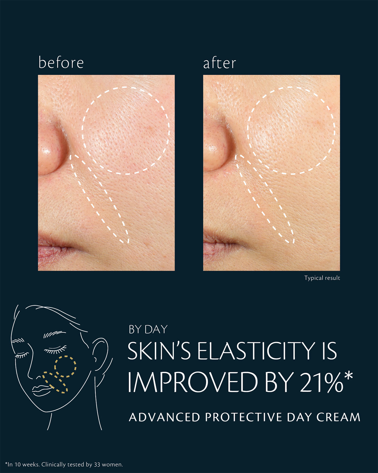 Photo comparing cheek skin before and after use of ADVANCED PROTECTIVE DAY CREAM, showing a 21% improvement in elasticity after 4 weeks. Clinically tested on 33 women.