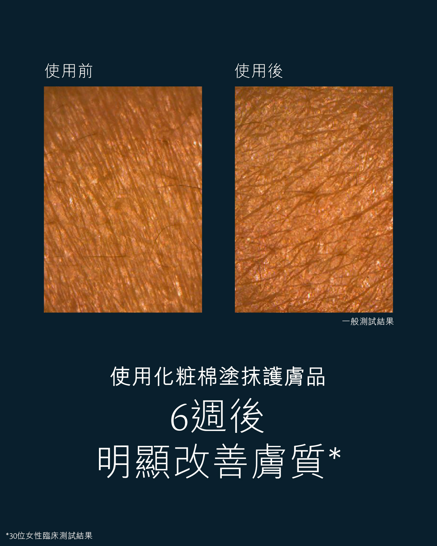 相片顯示以化粧綿塗抹護膚品6星期前後的肌膚效果。膚質更顯光滑均勻。34位女性進行的臨床測試結果。