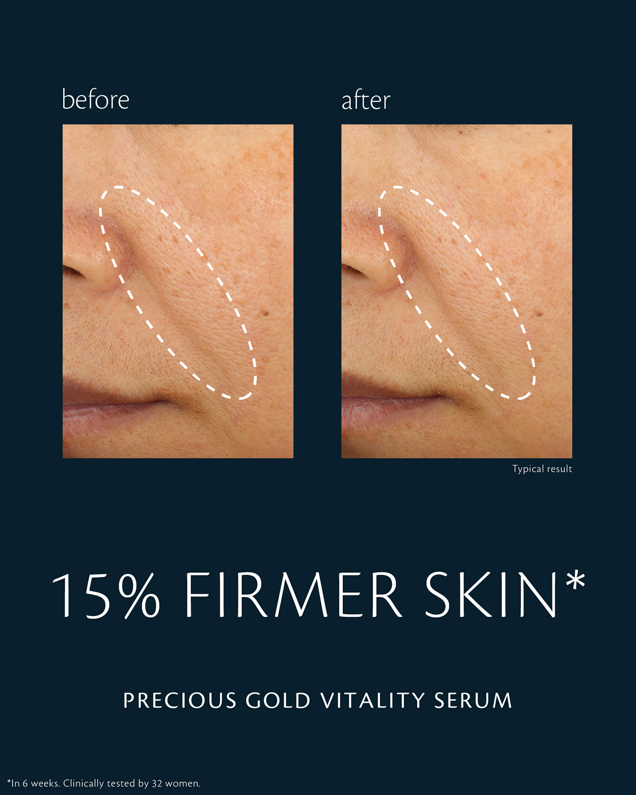 Photo of before-and-after comparison of skin using "PRECIOUS GOLD VITALITY SERUM." In the &ldquo;before&rdquo; image (left), skin firmness on the cheek appears diminished; in the &ldquo;after&rdquo; image (right), firmness is improved by 15%. Clinical test conducted over 6 weeks with 32 women.