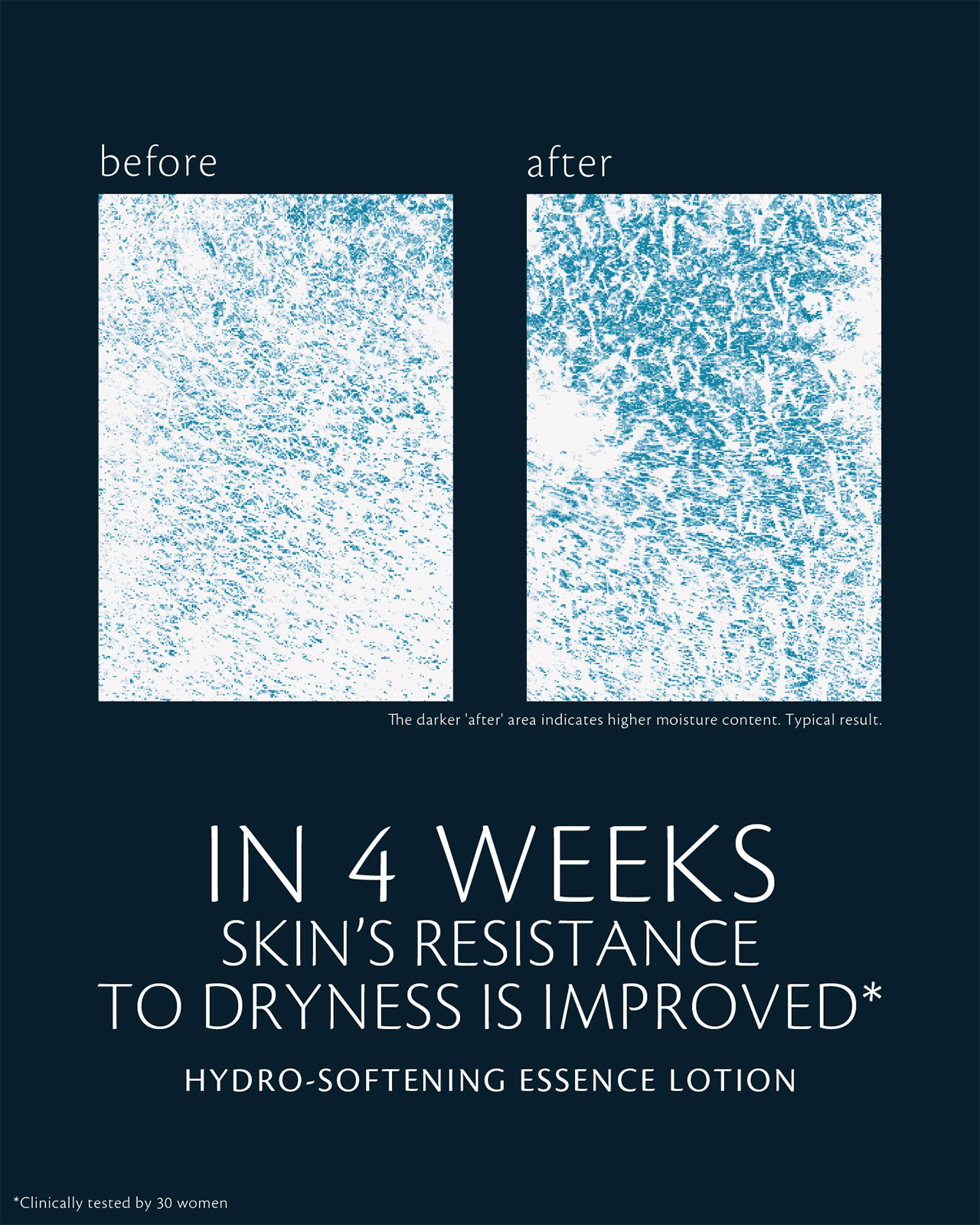 Photo of clinical test results for HYDRO-SOFTENING ESSENCE LOTION on 30 women, showing improved resistance to dryness after 4 weeks. The &ldquo;before&rdquo; image shows lower moisture content, and the &ldquo;after&rdquo; image shows darker areas indicating higher moisture content.