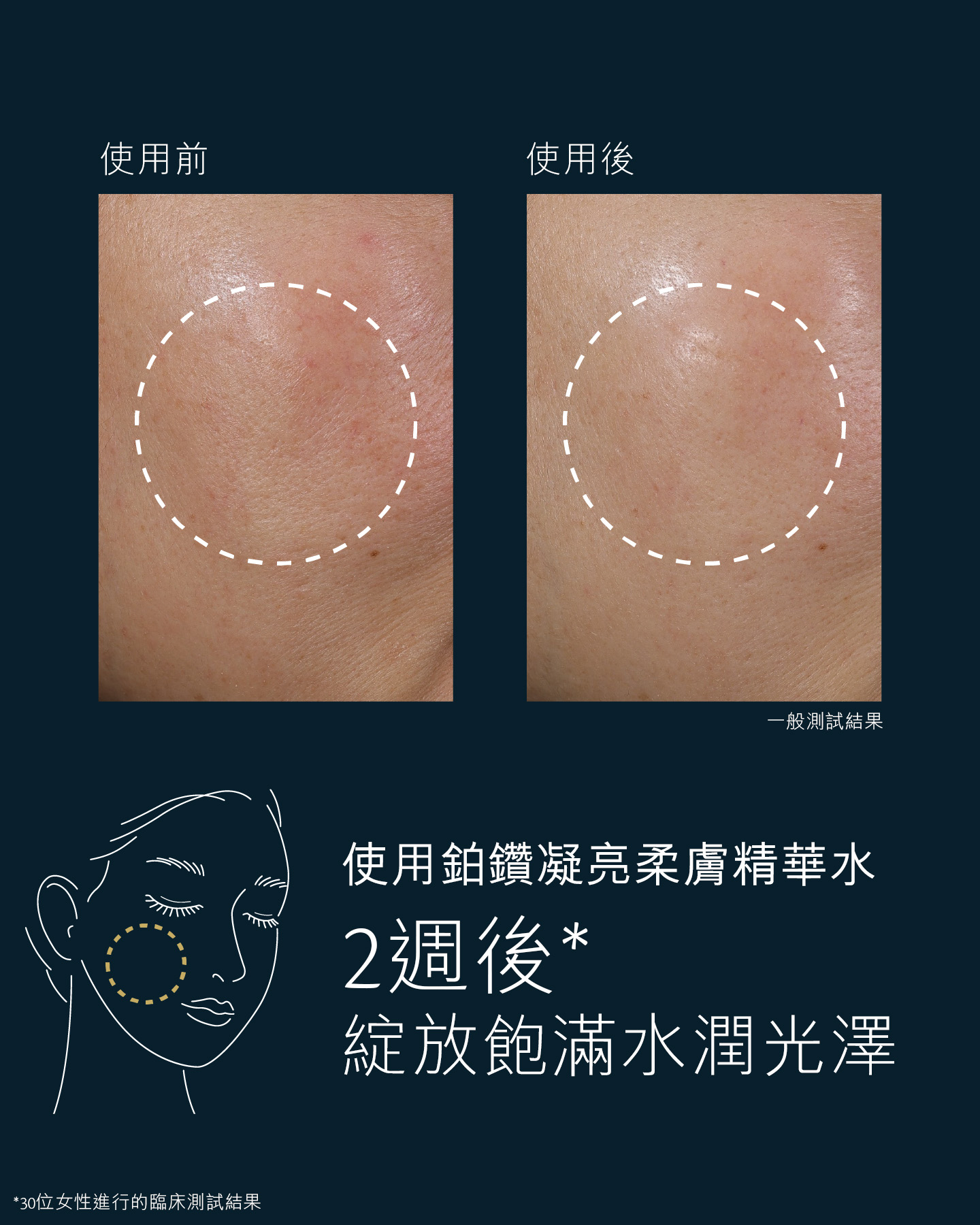 相片顯示30位女性使用鉑鑽凝亮柔膚精華水後進行的臨床測試結果，證明2星期後肌膚更具光澤，4星期後肌膚的儲水能力有所提升。圖片顯示使用產品前後的面頰區域對比，圈起的位置展示出肌膚明顯更柔滑水潤。