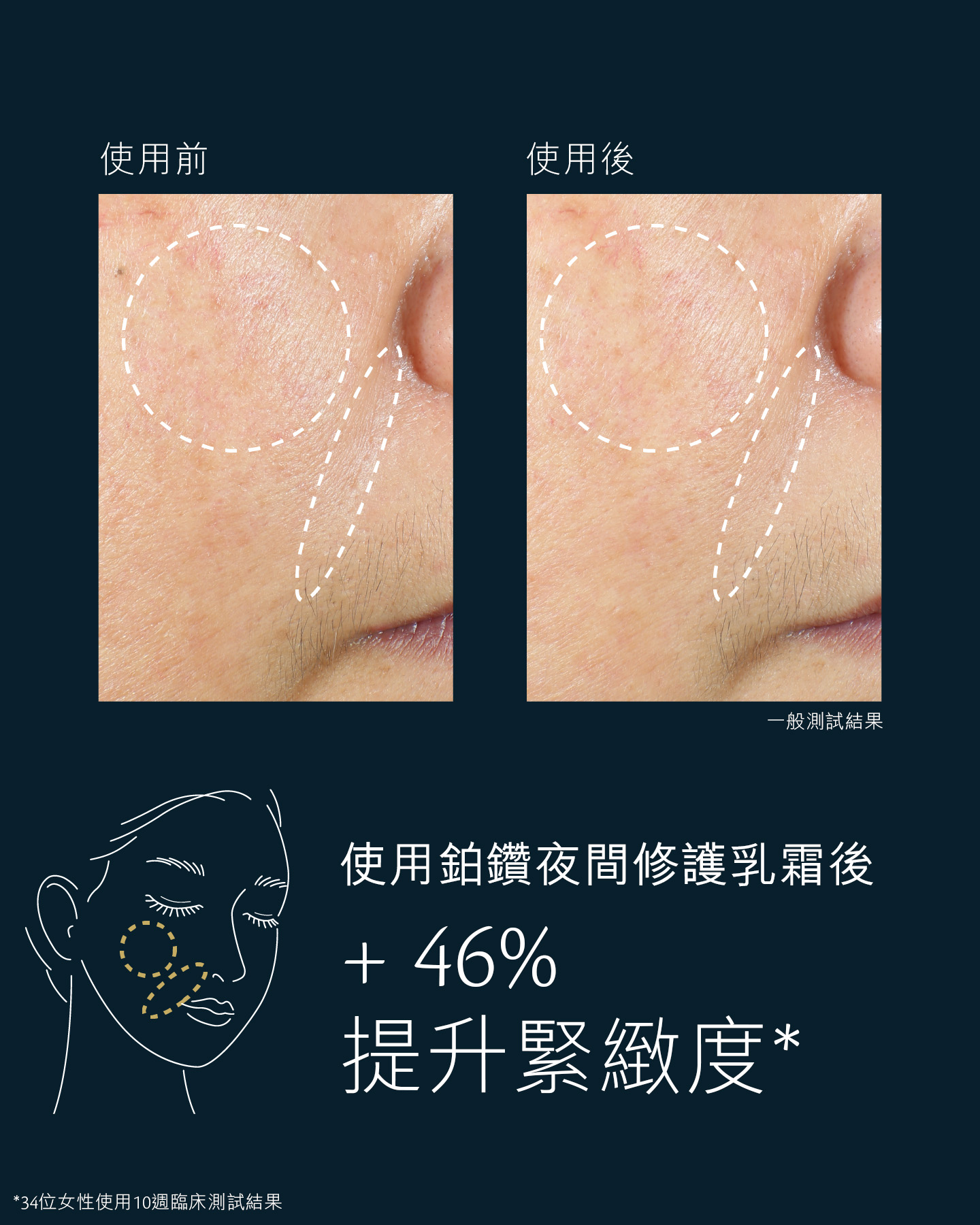 相片顯示使用鉑鑽夜間修護乳霜前後的面頰肌膚狀態對比。左邊「使用前」圖片顯示缺乏緊緻度，右邊「使用後」圖片顯示緊緻度提升了46%。經35位女性進行10星期臨床測試的結果。