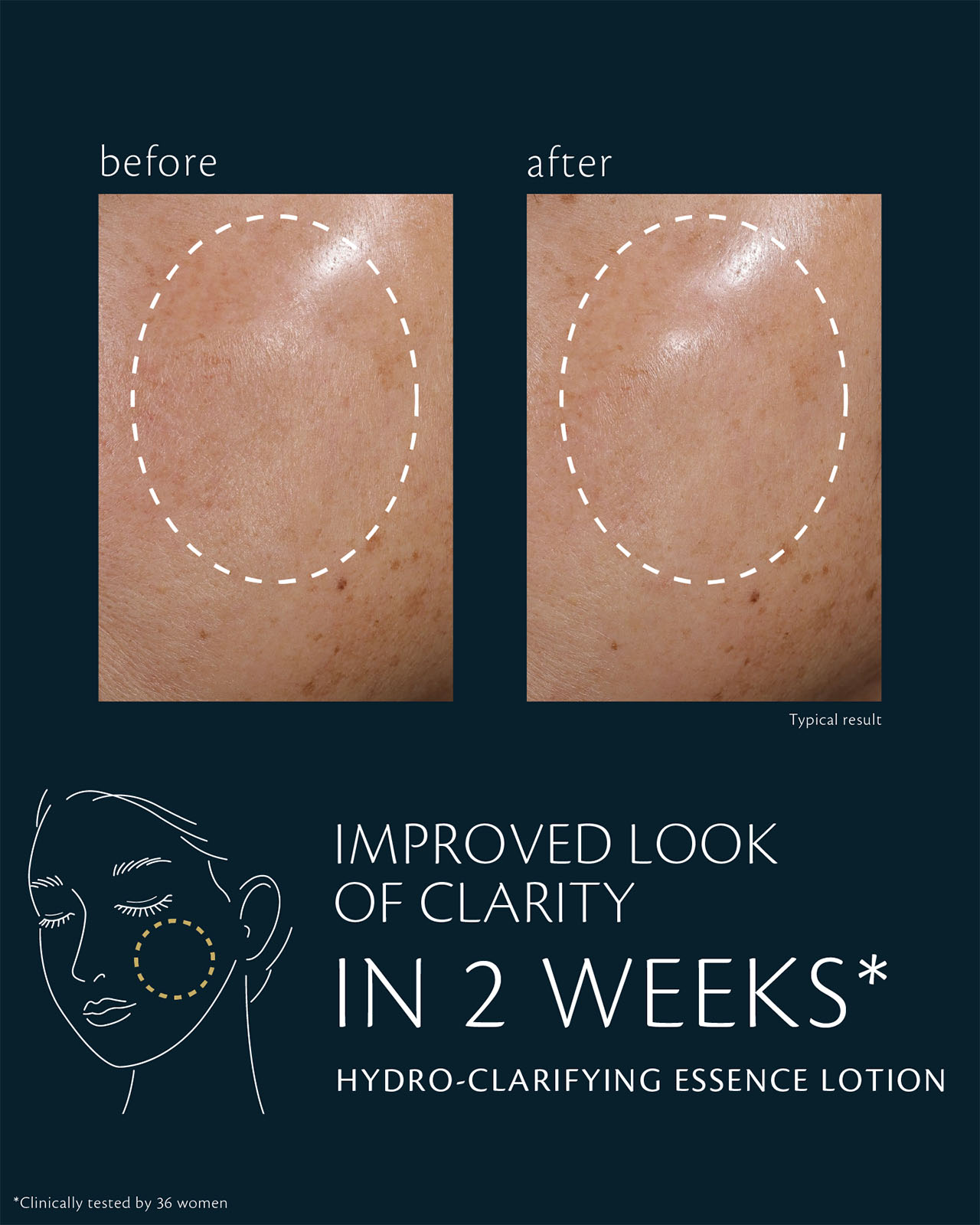 Photo of clinical test results for HYDRO-CLARIFYING ESSENCE LOTION on 36 women. After 2 weeks, skin shows a visibly hydrated glow. After 4 weeks, moisture retention and resistance to dryness improve. The image compares cheek areas before and after use, with the circled areas showing enhanced clarity.