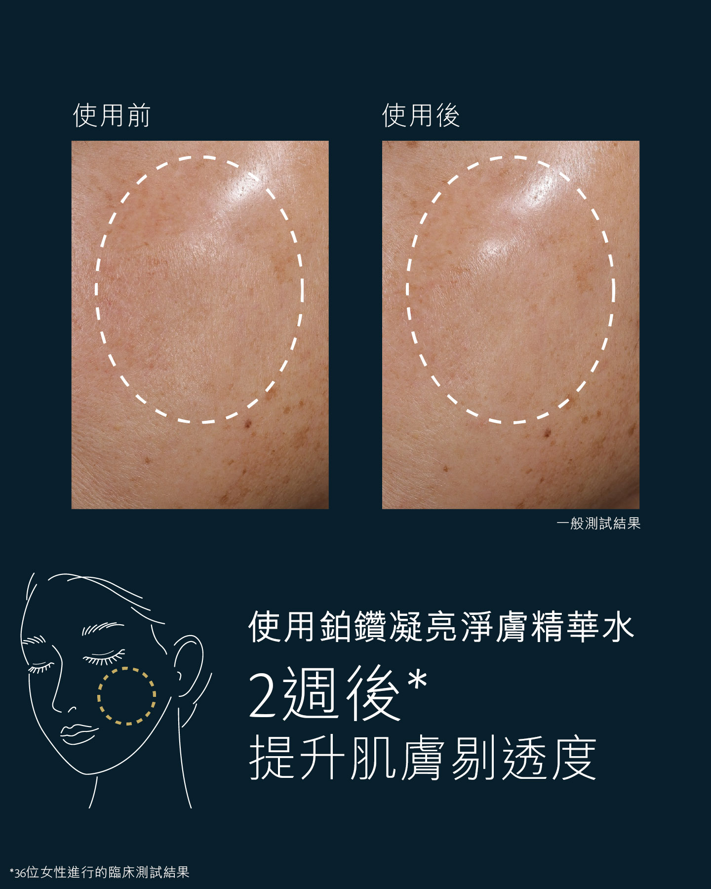 相片顯示36位女性使用鉑鑽凝亮淨膚精華水後進行的臨床測試結果。2星期後，肌膚煥發明顯的水潤光澤。4星期後，提升肌膚儲水能力和抵禦乾燥的能力。圖片顯示使用產品前後面頰區域的對比，圈起的位置展示出肌膚更顯淨透明亮。