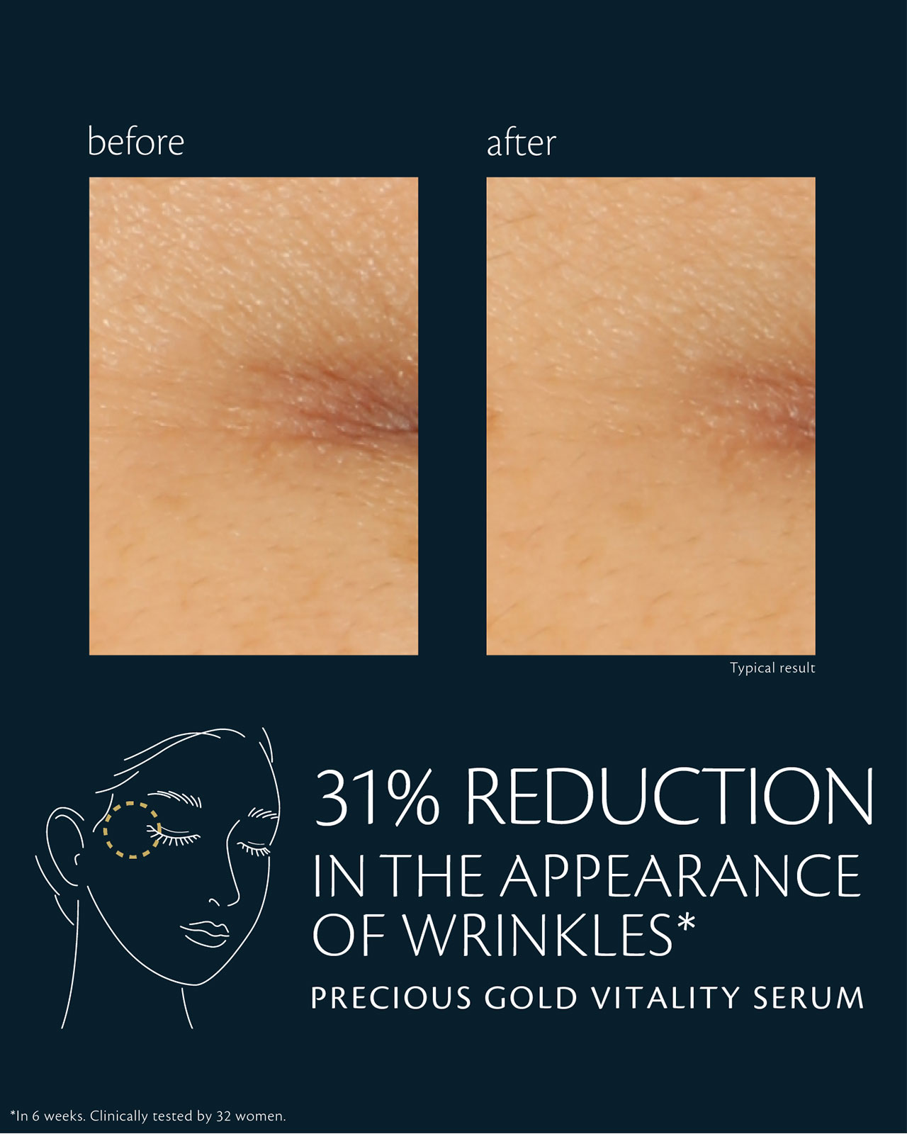 Photo of before-and-after comparison of skin using "PRECIOUS GOLD VITALITY SERUM." In the &ldquo;before&rdquo; image (left), crow&rsquo;s feet are more visible; in the &ldquo;after&rdquo; image (right), the appearance of wrinkles is reduced by 31%. Clinical test conducted over 6 weeks with 32 women.