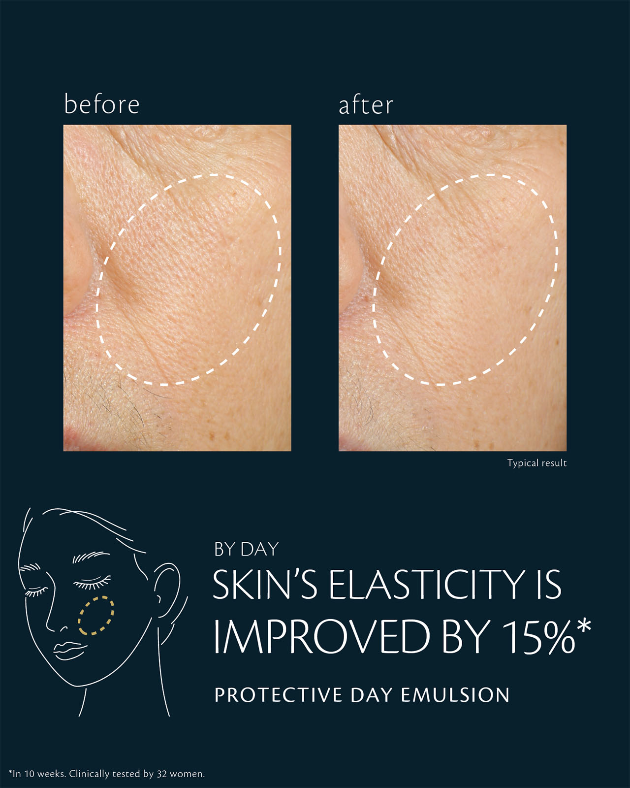 Photo of clinical test results for PROTECTIVE DAY EMULSION on 32 women, showing improved skin elasticity by 15% after 4 weeks and enhanced plumpness after 10 weeks. The image compares the eye area before and after use, with the circled areas showing visibly smoother texture, reduced pores, and diminished fine lines.