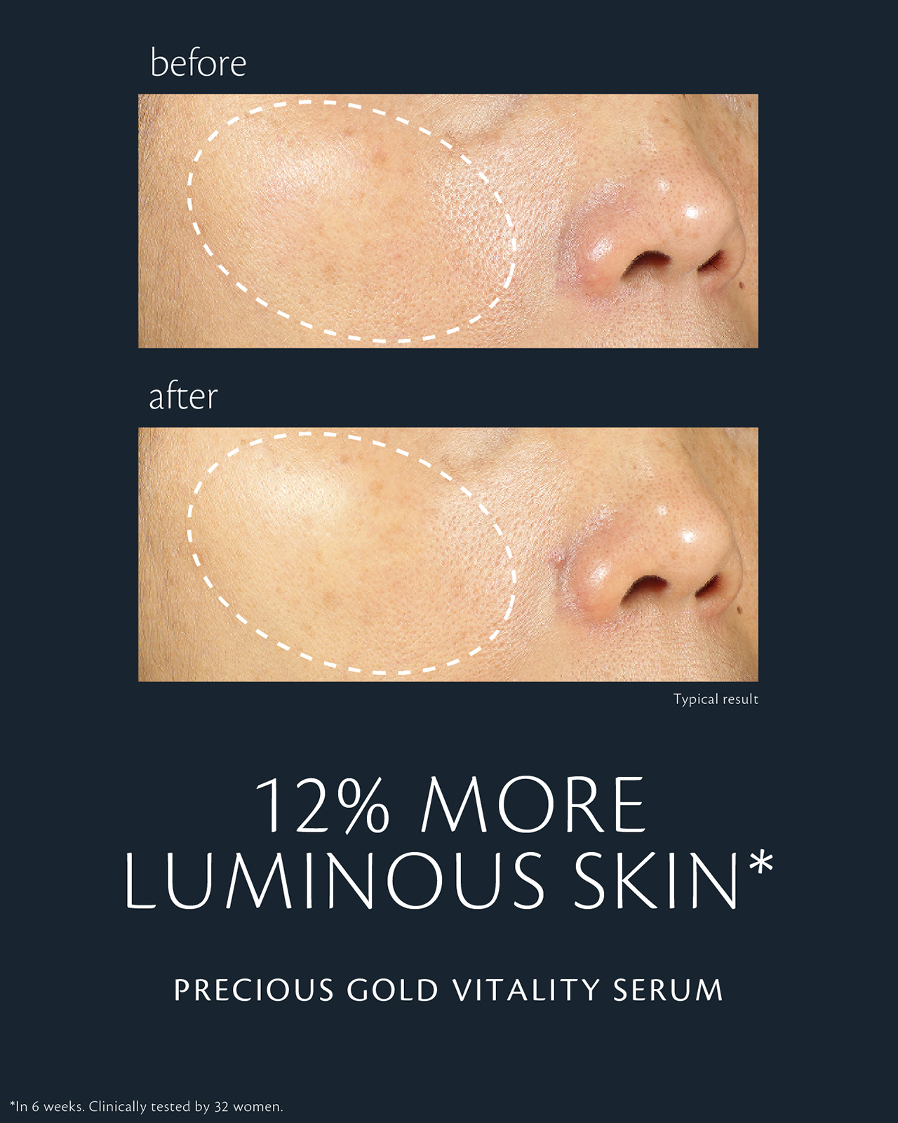 Photo of before-and-after comparison of skin using "PRECIOUS GOLD VITALITY SERUM." In the &ldquo;before&rdquo; image (top), skin appears less radiant; in the &ldquo;after&rdquo; image (bottom), radiance is improved by 12%. Clinical test conducted over 6 weeks with 32 women.