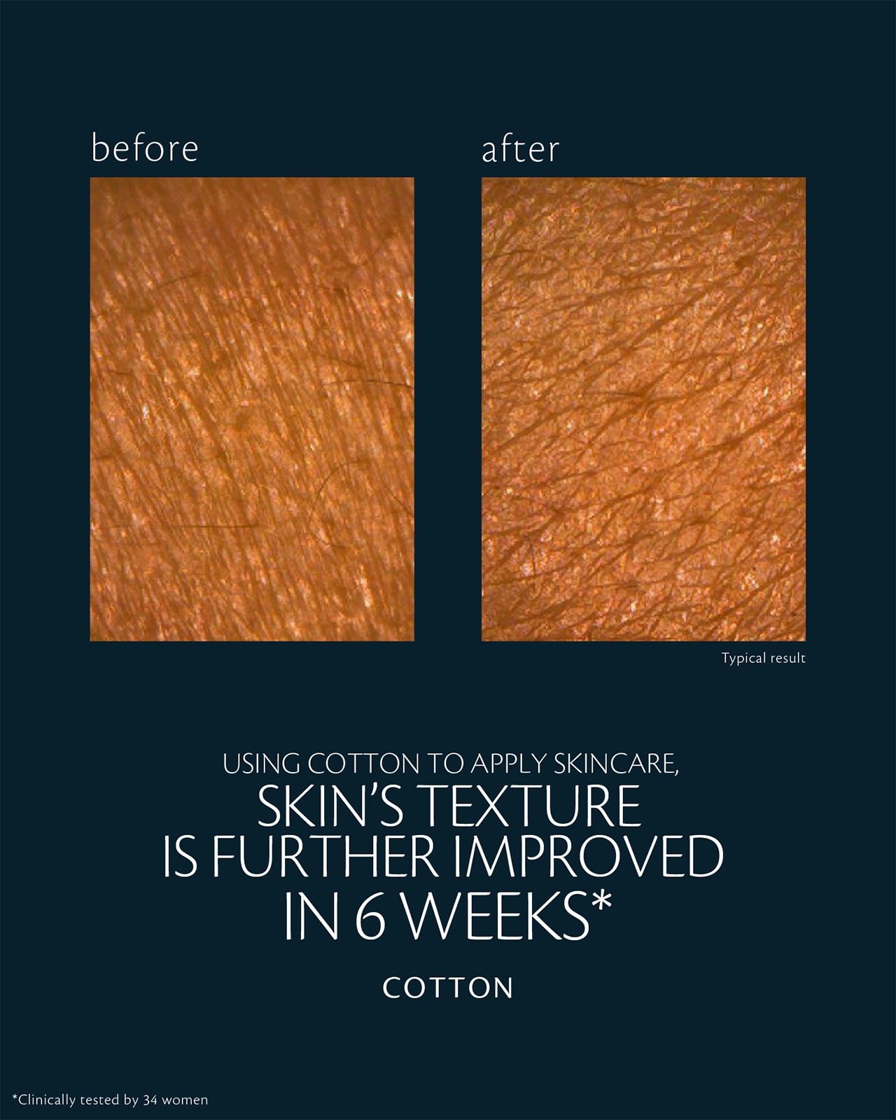 Photo of before-and-after skin results after 6 weeks of using skincare with cotton pads. Skin texture appears smoother and more even. Based on a clinical test with 34 women.