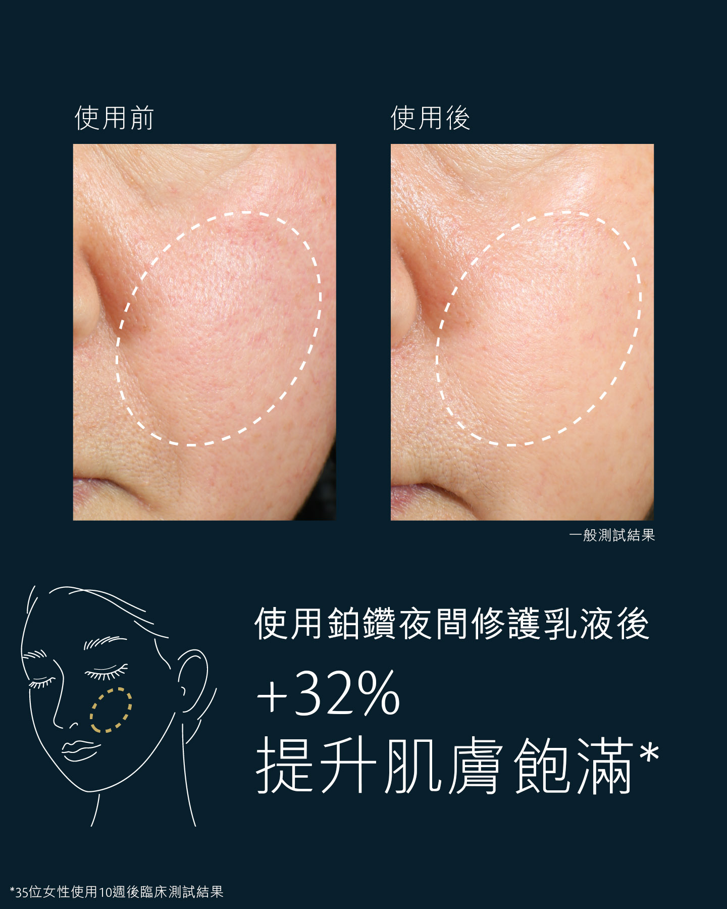 相片顯示面頰肌膚的前後對比，使用鉑鑽夜間修護乳液後飽滿度提升了32%。左邊（使用前）顯示肌膚乾燥和豐盈度稍微流失，右邊（使用後)顯示肌膚看起來更飽滿緊緻。*使用10星期，35位女性進行的臨床評分結果。