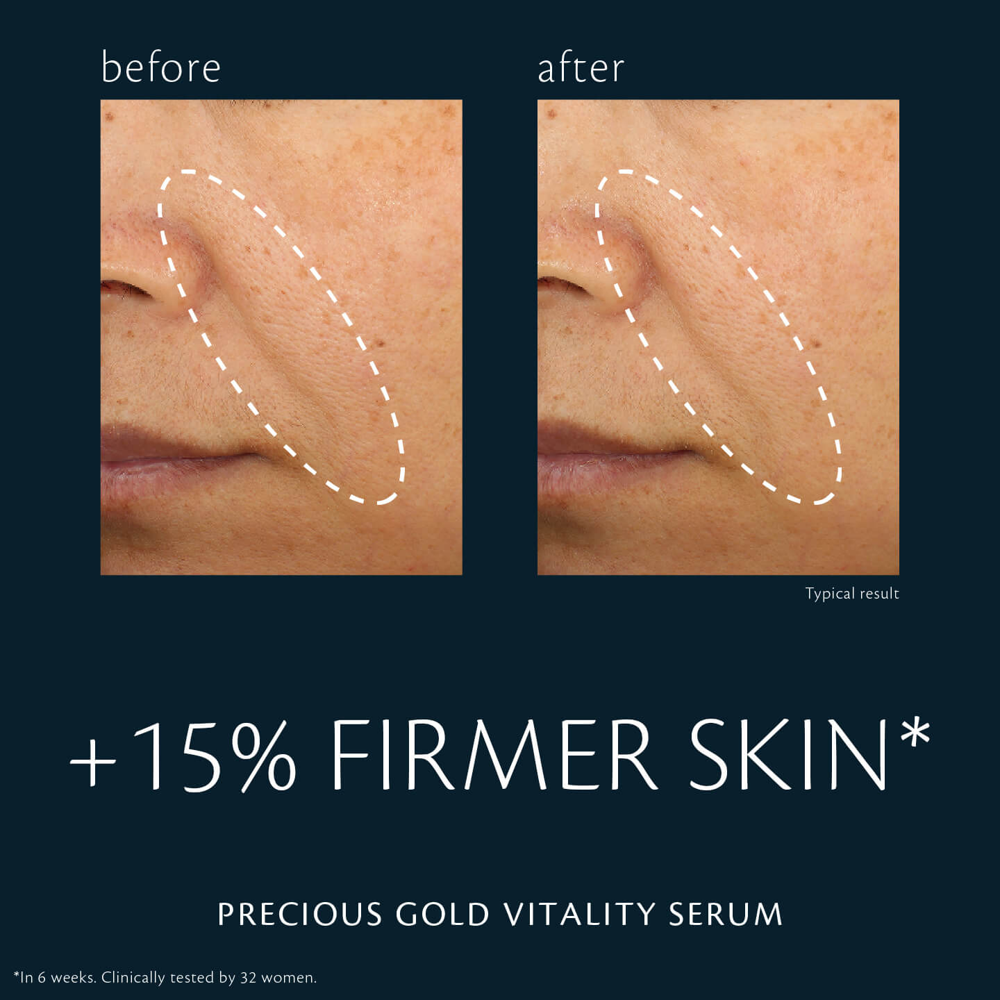 skincareregimen