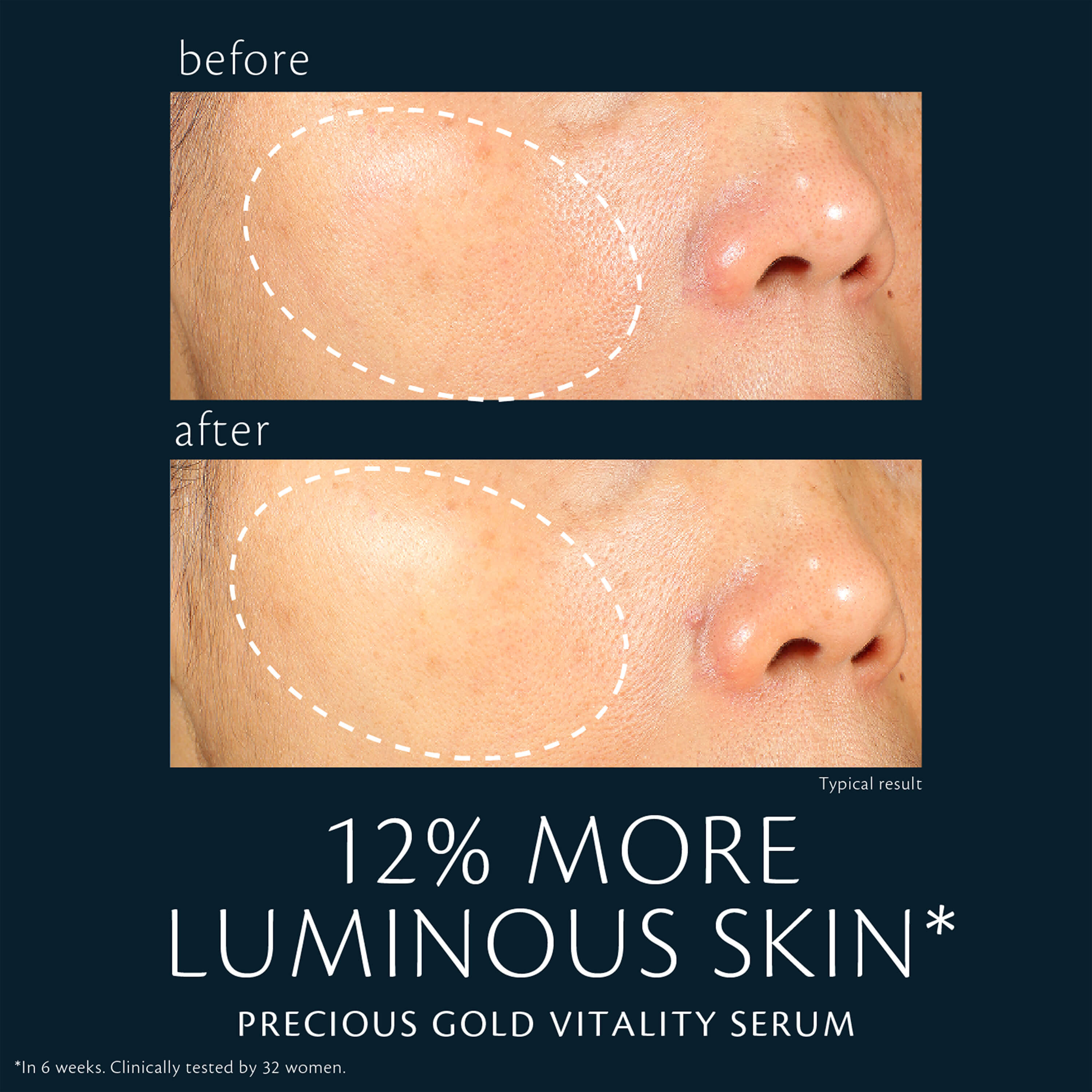 skincareregimen